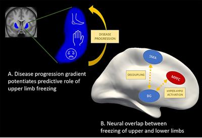 Can Motor Arrests in Other Effectors Be Used as Valid Markers of Freezing of Gait?